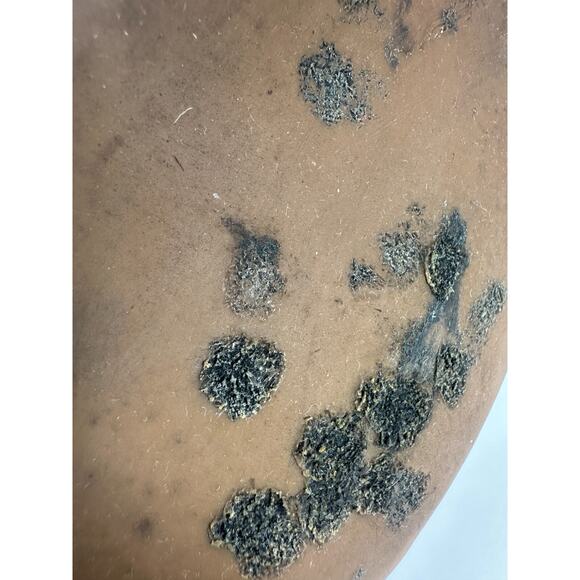 *Damaged Tory Burch Miller Leather Thong Sandals Flat Flip Flops Gold Logo 7.5 M - Picture 9 of 16